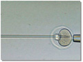 In vitro fertilization
