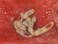Medical maggots