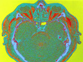 Brain scan