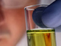 HIV/AIDS testing