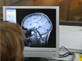 Brain scan