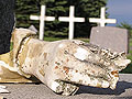 A broken hand
