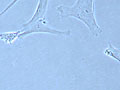Adult stem cells