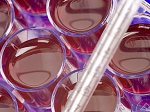 Stem cell cultures 