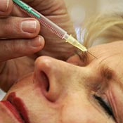 Patient get a Botox shot to her brow 