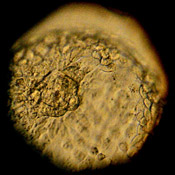A donated human embryo 