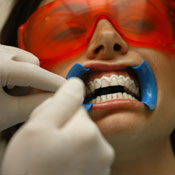 Woman getting teeth whitened 