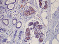 COX-2 enzyme