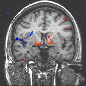Tess's actual brain scan.