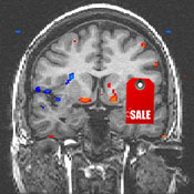 tess brain scan 