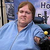 Thalidomide victim Lorraine Mercer 