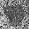 St. Louis encephalitis