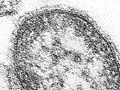 Measles virus