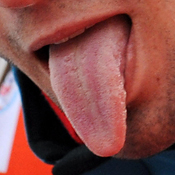 Tongue 