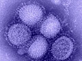 H1N1 influenza virus
