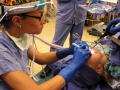 Tonsil surgery