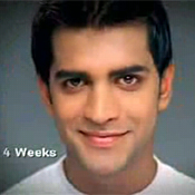 Indian male with lighter skin after four weeks of using Fair & Handsome cream