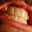 Grinding teeth