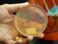 E. coli O157:H7