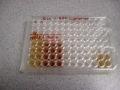 Cancer cell enzymes