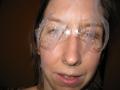 Healing from water balloon injuries