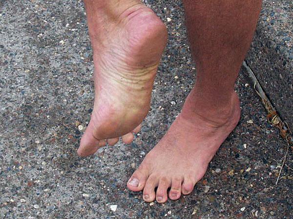 barefoot runner feet