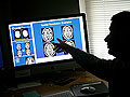 Brain scan resolutions