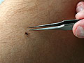 Black-legged ticks