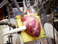 Visible heart lab