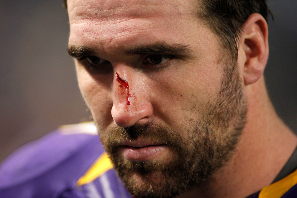 Jared Allen