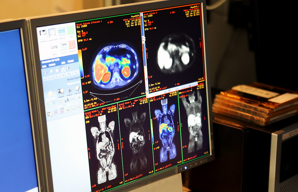 PET scan images