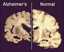 Larger view