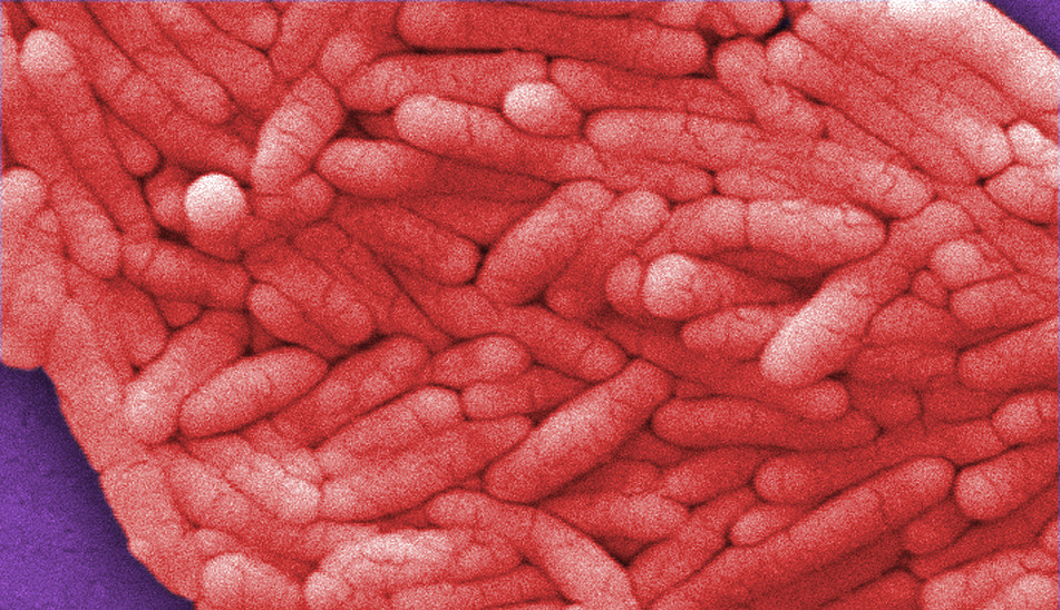 Salmonella outbreaks in Minnesota What you need to know Minnesota Public Radio News